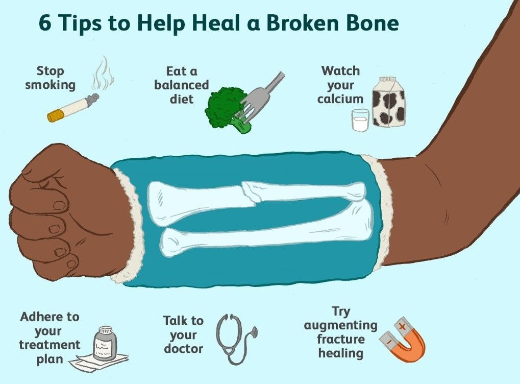 Best Therapy for Bone Healing After Surgery in Sector 51 Gurugram