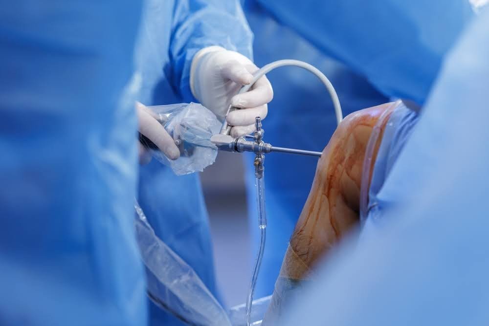 Best Arthroscopy Surgery in Gurugram