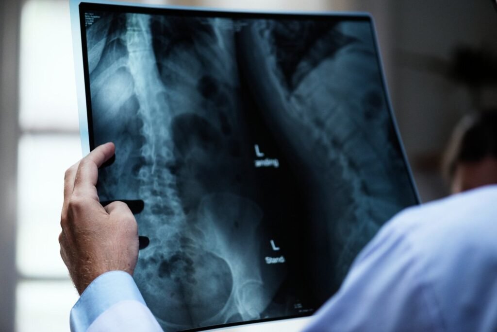 Spine Surgery in Sector 51 Gurugram