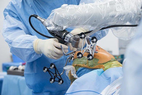 Robotic Knee Replacement Surgeon in Gurugram